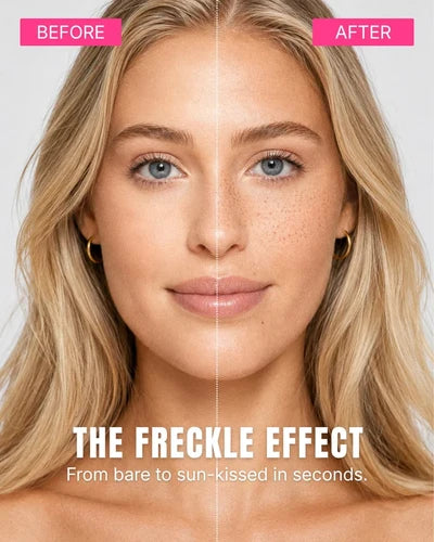 Edluxe FrecklePen™